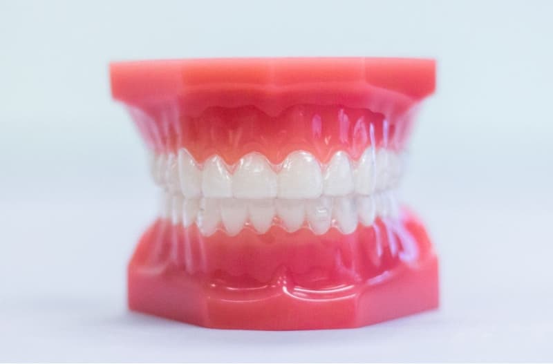 clear aligners on plastic typodont