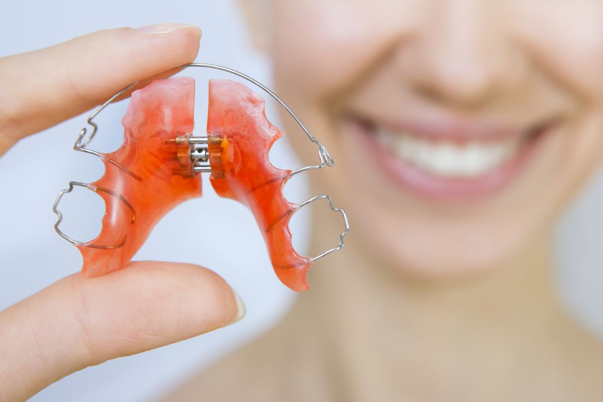 How to Take Care of Your Retainer