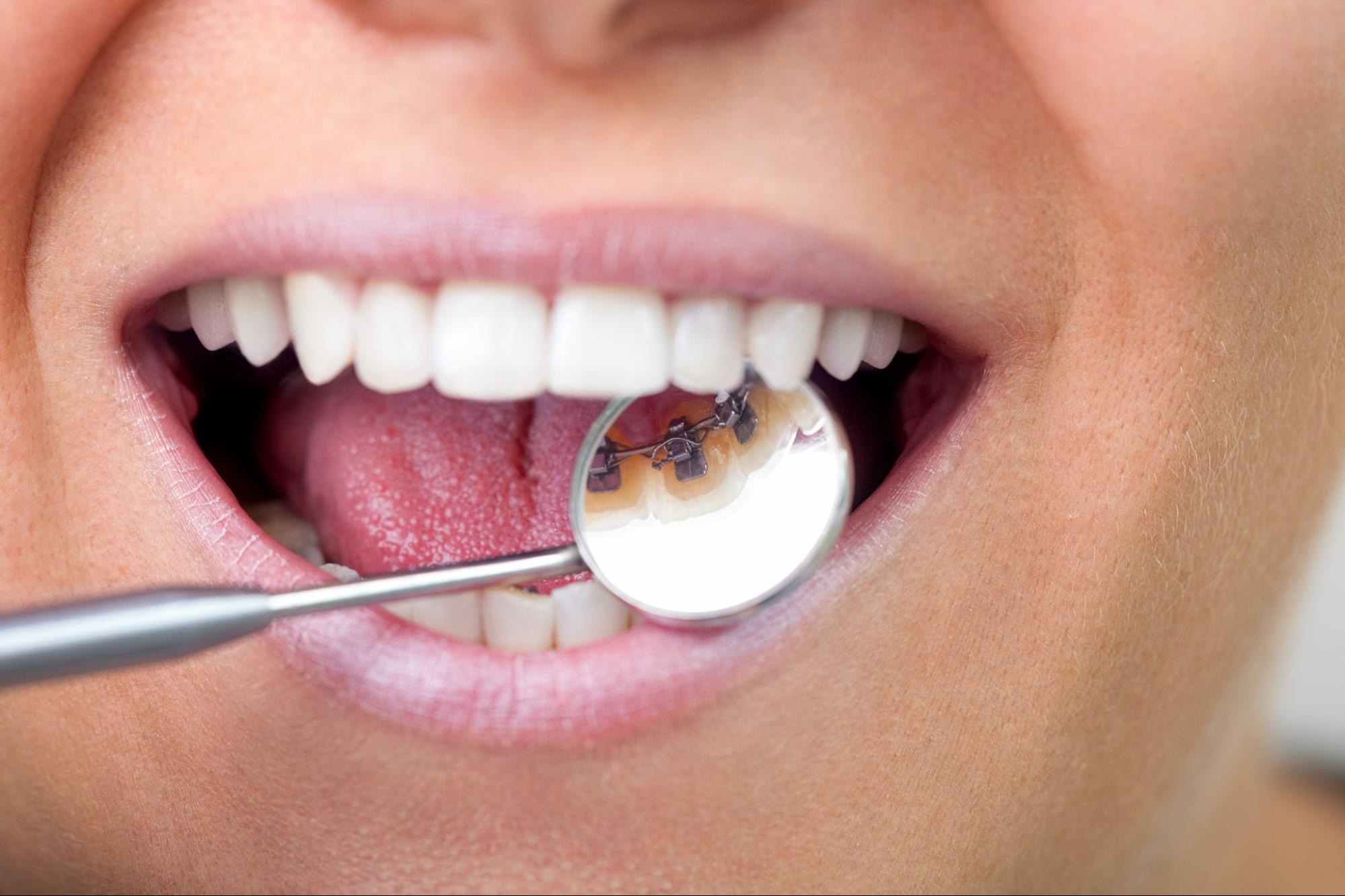 Advancements in Orthodontics