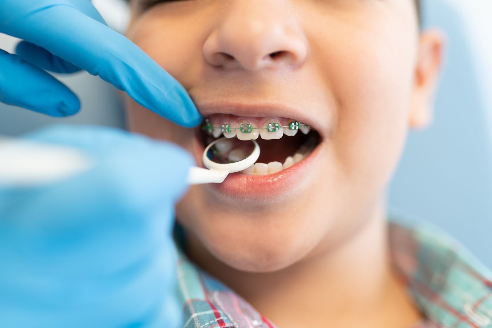 How Can Orthodontic Treatment Benefit My Child's Oral Health?&nbsp;